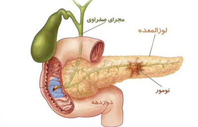 دریافت سوال 5